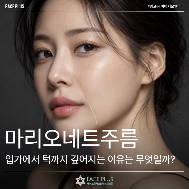 마리오네트주름, 입가에서 턱까지 깊어지는 이유는 무엇일까?