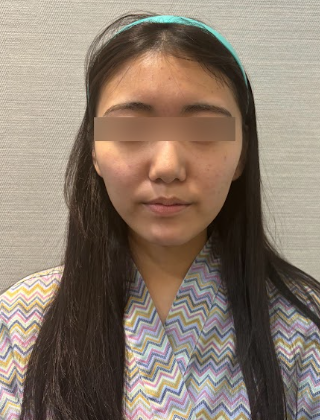신논현실리프팅, 같은 시술인데 결과가 달라지는 이유는? 사진 4