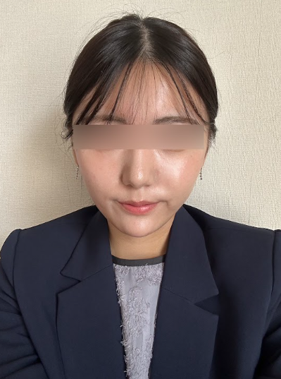신논현실리프팅, 같은 시술인데 결과가 달라지는 이유는? 사진 5