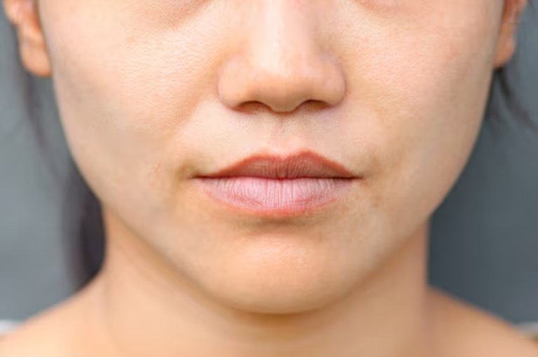 볼처짐, 심부볼처짐 나이 들수록 심해지는 이유는? 사진 8