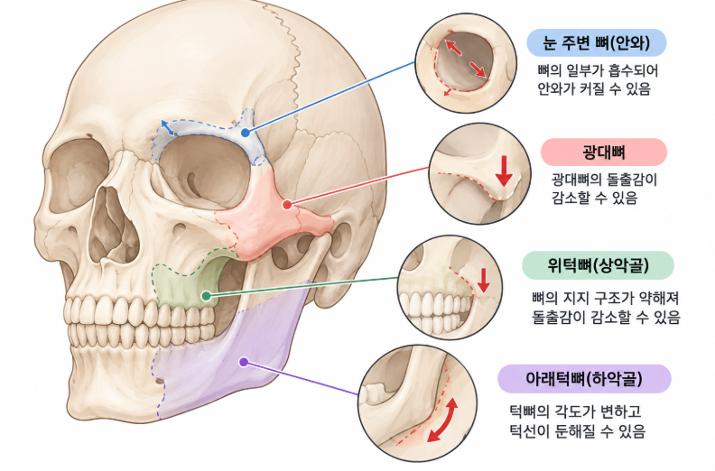 볼처짐, 심부볼처짐 나이 들수록 심해지는 이유는? 사진 6