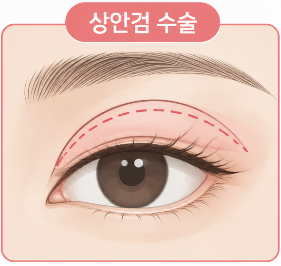안티에이징수술, 얼굴이 예전보다 피곤해 보이는 이유 사진 7