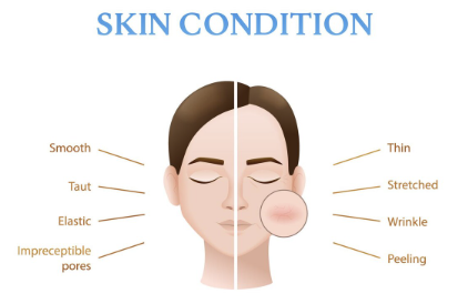 안검하수수술, 수술비와 회복기간 얼마나 걸릴까? 사진 7