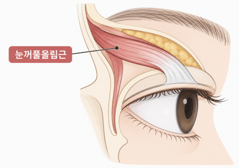 안검하수수술, 수술비와 회복기간 얼마나 걸릴까? 사진 9