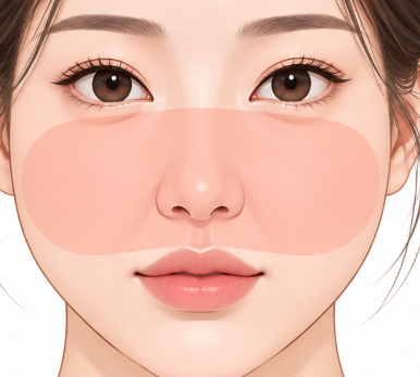 중안부리프팅, 필러만으로 해결되지 않는 얼굴처짐이라면? 사진 6