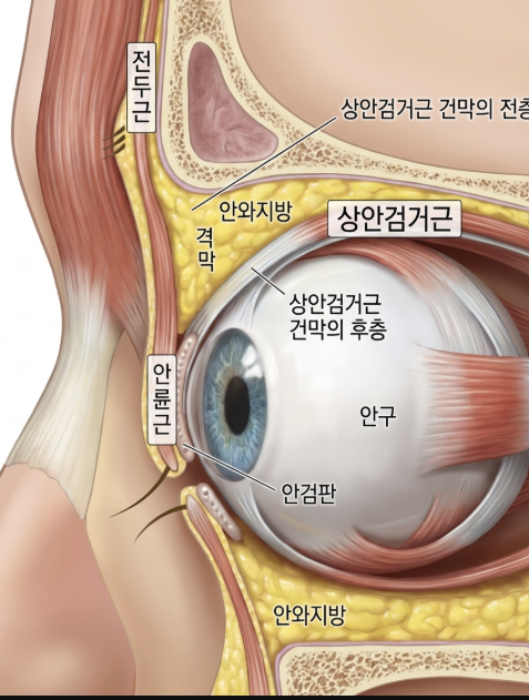 상안검부작용, 수술 후 눈매가 더 사나워 보이는 이유는? 사진 10