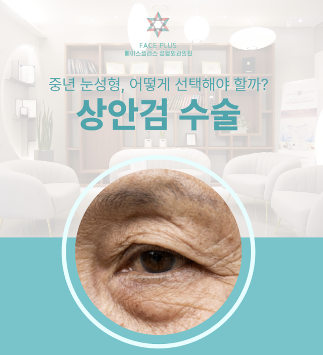 상안검부작용, 수술 후 눈매가 더 사나워 보이는 이유는? 사진 2
