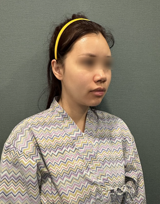 땅콩형, 중안부가 길어 보이고 둥근턱선까지 고민이라면? 사진 5
