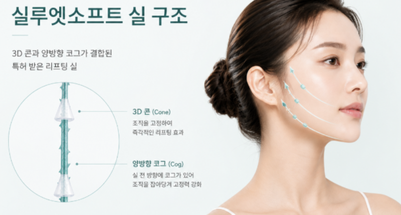 녹는실리프팅, 실 종류에 따라 유지기간이 달라질까?