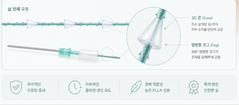 녹는실리프팅, 실 종류에 따라 유지기간이 달라질까? 사진 8