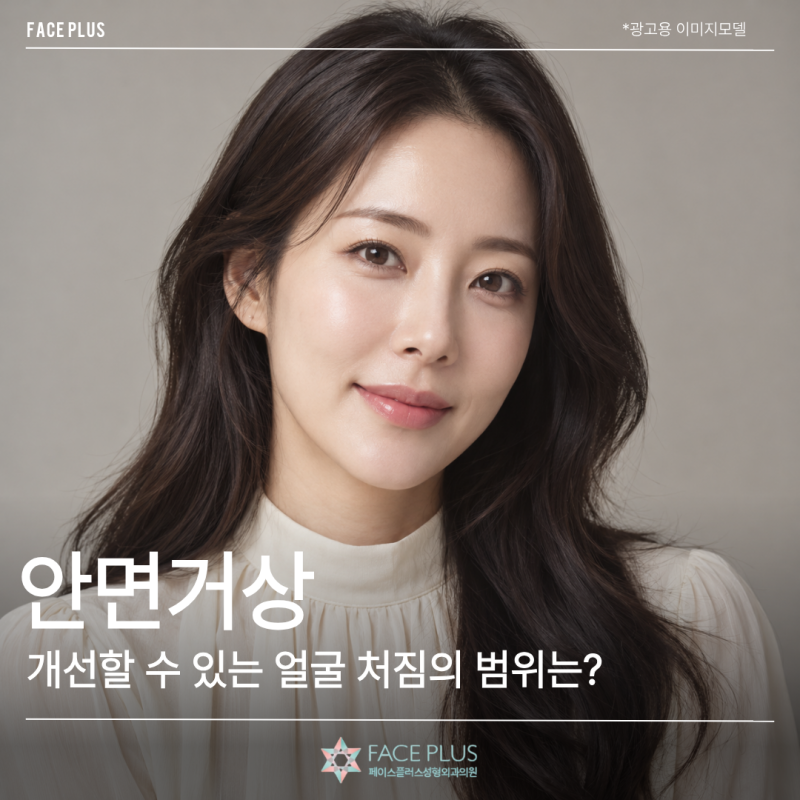 안면거상술, 몇 살부터 고려할까? 개선할 수 있는 얼굴 처짐의 범위는? 사진 2